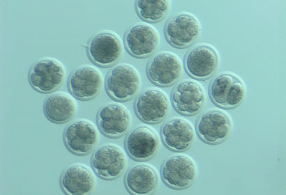 IVF（in vitro fertilization、体外受精）