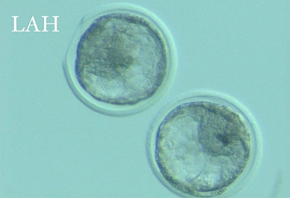 新鮮胚移植もしくは、凍結保存